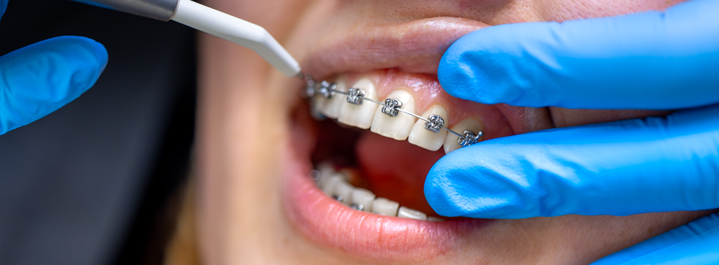 Orthodontics