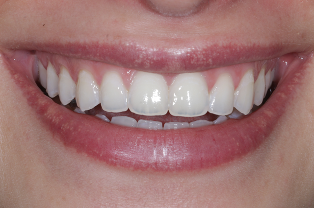 Sonrası